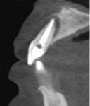 3D Cone Beam CT (sagittal view)